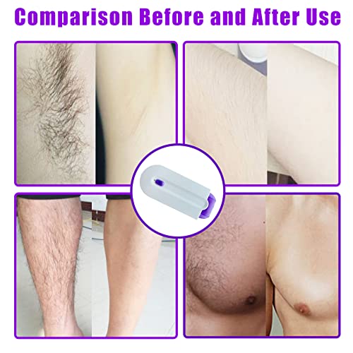 Portable Rechargeable Hair Removal Device